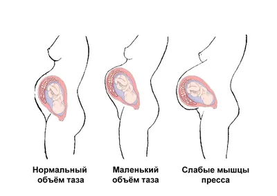 Размер живота во время беременности