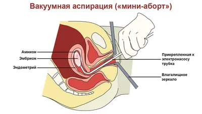 Блогер показала анкету про аборт с вопросами о душе ребенка из клиники  Иркутска - TOPNews.RU