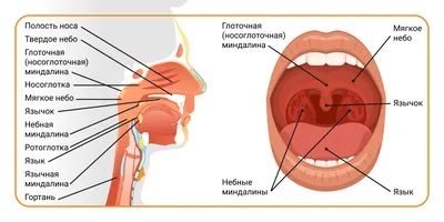 Почему может болеть горло? - Медицинский центр «Добрый Доктор»