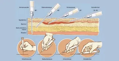 ᐈ Как лечить флебит? ~【Диагностика воспаления вен в Киеве】