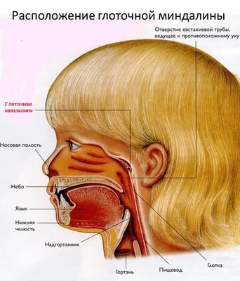 Что такое аденоидит (воспаление аденоидов) и как его лечить – Соль Здоровья