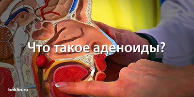 Заложенный нос, аденоиды, снижение слуха: как поможет многопрофильный  медицинский центр Medical Balance - KP.RU