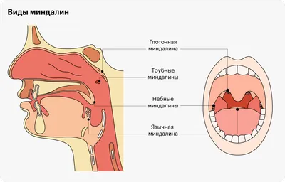 Удаление аденоидов у детей: есть ли побочные эффекты? | KidsAge - Детский  возраст | Дзен