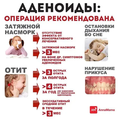 Аденоиды у детей: симптомы по стадиям развития. Лечение аденоидов у ребенка  в Москве. Аденоидит и его лечение.