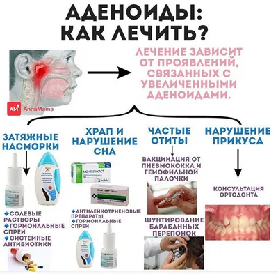 ЛОР-врач в клинике в Москве вылечит аденоиды у детей в любой степени  гипертрофии