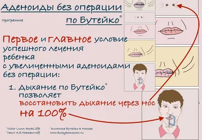 Аденоиды - разрастание лимфоидной ткани - ЛОР в Самаре - врач Лунёв Андрей  Владимирович