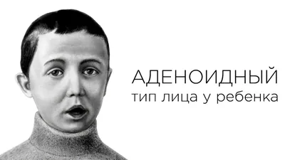 Аденоиды. Что это такое, как лечить, и в каком случае удалять?  Врач-оториноларинголог рассказала