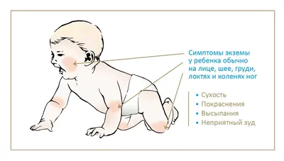 Лосьон Неотанин - «Акне новорождённых быстро подсушились благодаря  неотонину! Здоровая кожа без покраснений и зуда » | отзывы