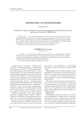 💢Акромегалия (от греч. acron-конечность; megalos-огромный) -  нейроэндокринная патология, характеризующаяся нарушением функции гипофиза  и… | Instagram