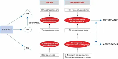 Акромегалия – болестта на „големите крайници“, 2 | Puls.bg