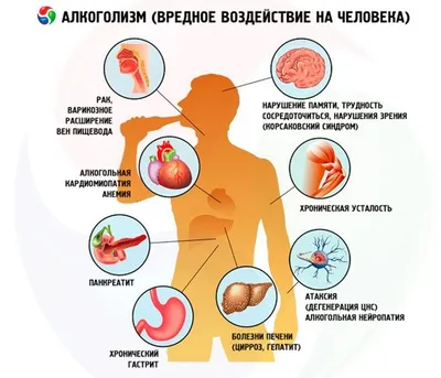 Основные виды алкоголизма