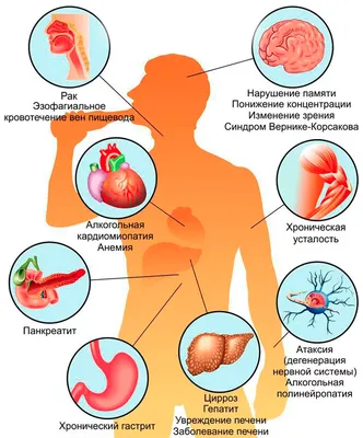 Полинейропатия верхних и нижних конечностей: причины и симптомы, лечение в  Москве