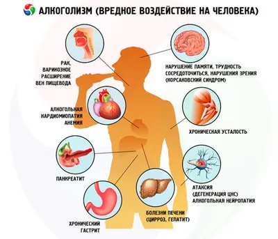 Женский алкоголизм — особенности лечения алкоголизма у женщин - NewLife –  наркологический центр в Киеве