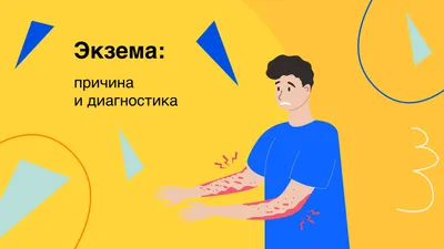 Экзема: причины, чем лечить и мазать, как выглядит экзема на руках, ногах,  лице и пальцах