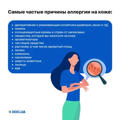 Аллергия на коже: симптомы и причины | Диагностика и лечение кожной аллергии  в АО «Медицина»