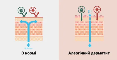 Как выглядит аллергический дерматит? ~ Лечение в Киеве