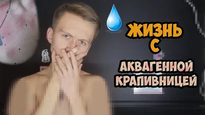 Аллергия на воду - это возможно?