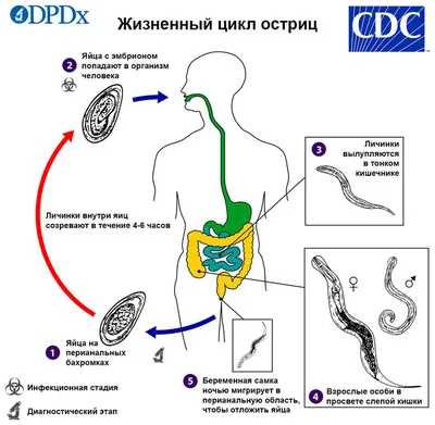 Глисты (гельминты): лечение, признаки и профилактика гельминтоза