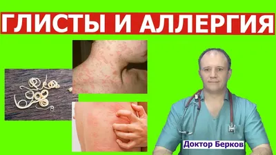 Глисты и аллергия - это опасно! - YouTube