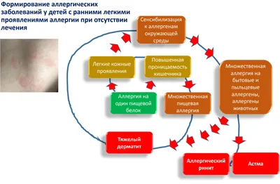 Аллергия у ребенка на шерсть домашних животных. | Клуб Успешных Врачей |  Дзен