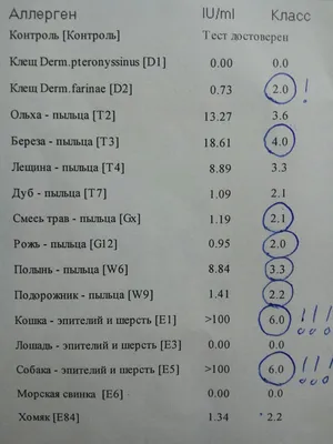 Ученые из Сеченовского университета создают вакцину против аллергии на собак  - Вести Московского региона