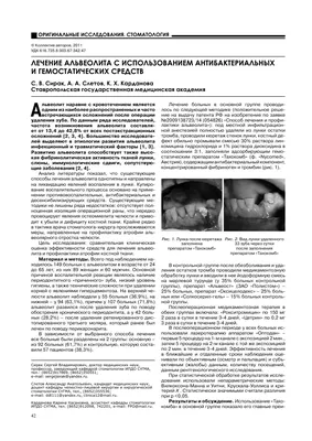 EDULASE - ⚜АЛЬВЕОЛИТ.⚜ ⚜Альвеолит – это острое воспаление стенок лунки на  месте удаленного зуба. ⚜Характеризуется сильной болью в лунке, нарушением  общего состояния (слабостью, повышенной температурой тела, головной болью),  увеличением подчелюстных ...