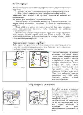 Достоверен ли анализ мочи?