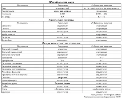 Зачем сдавать общий анализ мочи?