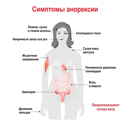 Синдром избыточного бактериального роста: чем он опасен - Рамблер/доктор