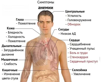 Железодефицитная анемия. Дефицит железа в организме - причины появления,  симптомы заболевания, диагностика и способы лечения