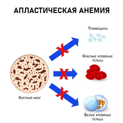 Анемия у детей: симптомы, признаки, методы лечения и профилактика