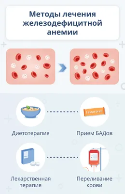 Симптомы анемии Железодефицитная анемия Иллюстрация вектора - иллюстрации  насчитывающей ветромера, обработка: 93398046