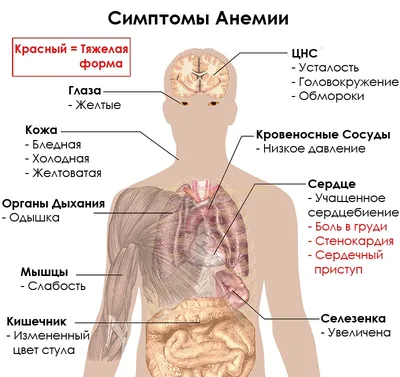 Анемия у детей: симптомы, признаки, методы лечения и профилактика