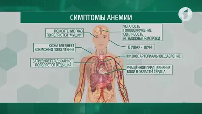 Железодефицитная анемия - БСМП Гродно