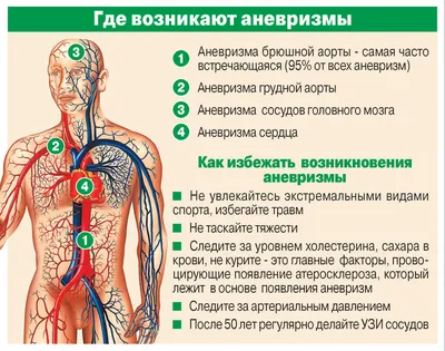 АНЕВРИЗМА-как бомба замедленного действия