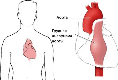 Клипирование - вся информация