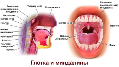 Ангины:вирусная и бактериальная. | AnnaMama