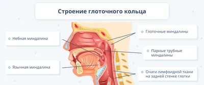 Гнойная ангина: лечение у взрослых и у ребенка, фото, чем полоскать