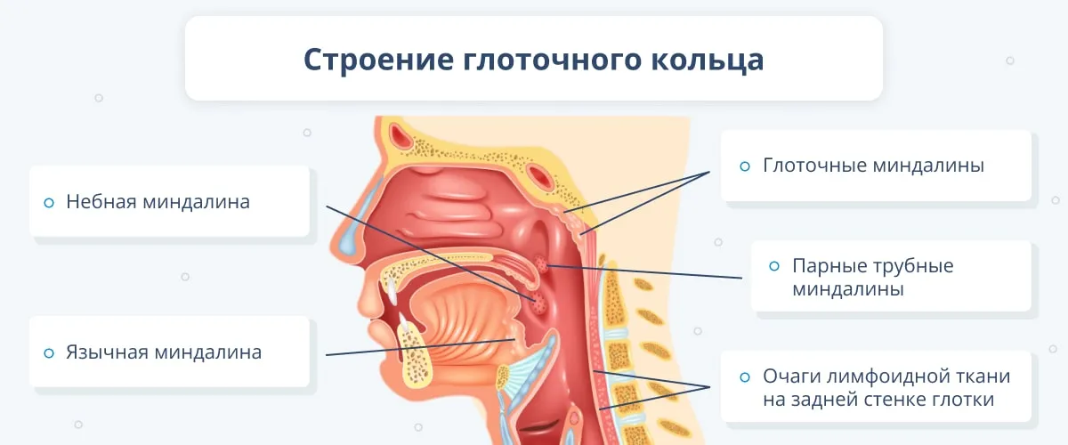 Стрептококковый тонзиллит мкб. Воспаление глоточной миндалины. Небные миндалины воспалены.