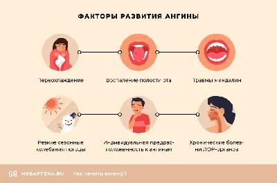 Как определить ангина вирусная или бактериальная?