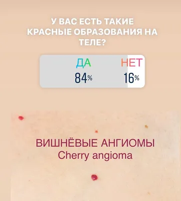 Ангиомы на губах у женщин | Центр сосудистой патологии \"ГЕМАНГИОМА\" | Дзен