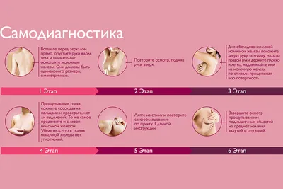 Боль в молочной железе (масталгия): симптомы, причины и лечение в ФНКЦ ФМБА