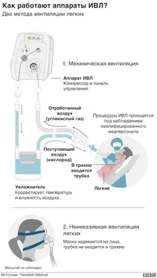 Аппарат ИВЛ Авента-М (c встроенным модулем пульсоксиметрии и капнометрии) ›  Купить оптом и в розницу › Цена от завода