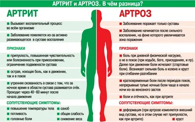 Артроз и артрит - в чем разница? Методы диагностики и лечения | медицинские  товары и медтехника в магазине Ортосалон