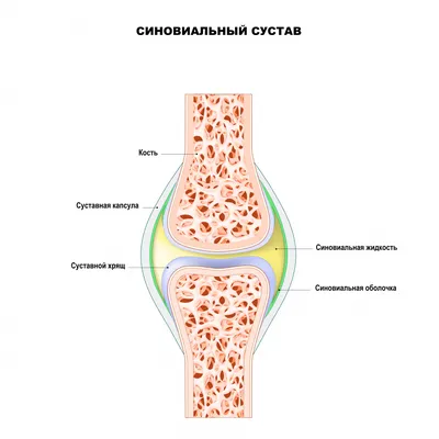 Реактивный артрит - симптомы острой и хронической форм, стадии и признаки у  мужчин и женщин, причины появления, диагностика и лечение заболевания