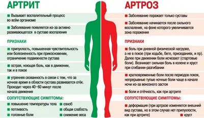 Виды, признаки и симптомы артрита. Лечение и профилактика в домашних  условиях | Солнышко