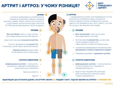 Артрит | Признаки, причины, симптомы и лечение воспаления суставов