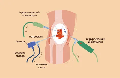 Интересное | Ревматоидный артрит, Лечение, Домашние маски для лица