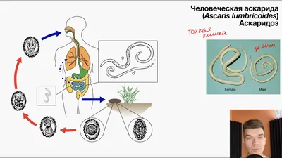 7. Аскарида человеческая. Общие черты строения круглых червей