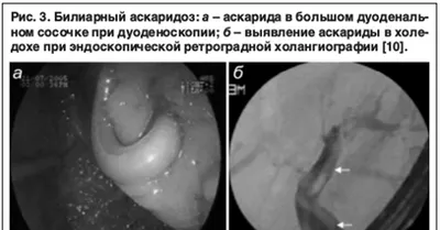 Жизненный цикл аскариды рисунок - 87 фото